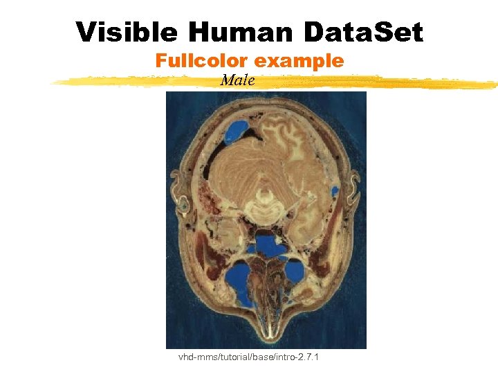 Visible Human Data. Set Fullcolor example Male vhd-mms/tutorial/base/intro-2. 7. 1 