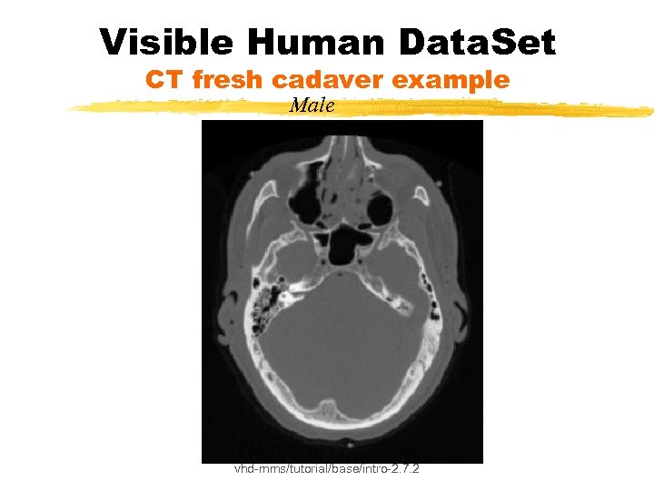 Visible Human Data. Set CT fresh cadaver example Male vhd-mms/tutorial/base/intro-2. 7. 2 