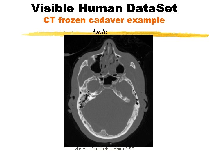 Visible Human Data. Set CT frozen cadaver example Male vhd-mms/tutorial/base/intro-2. 7. 3 