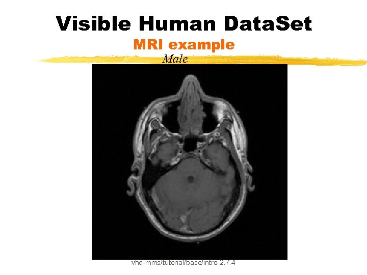 Visible Human Data. Set MRI example Male vhd-mms/tutorial/base/intro-2. 7. 4 