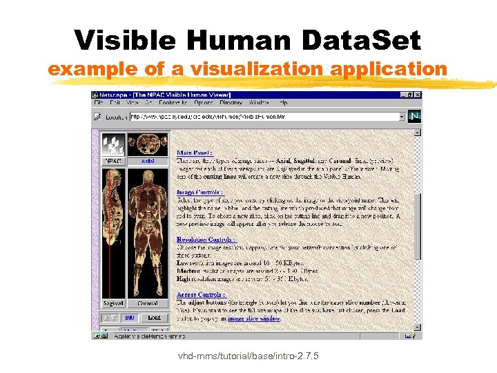 Visible Human Data. Set example of a visualization application vhd-mms/tutorial/base/intro-2. 7. 5 