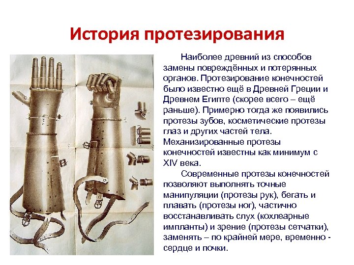 История протезирования Наиболее древний из способов замены повреждённых и потерянных органов. Протезирование конечностей было