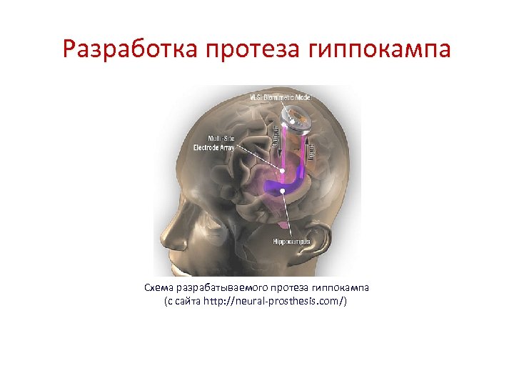 Разработка протеза гиппокампа Схема разрабатываемого протеза гиппокампа (с сайта http: //neural-prosthesis. com/) 