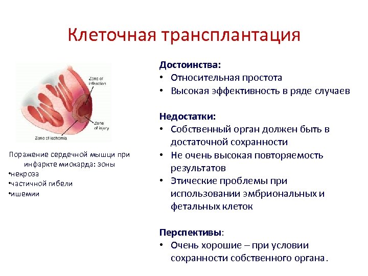 Проект искусственные органы проблема и перспективы цель