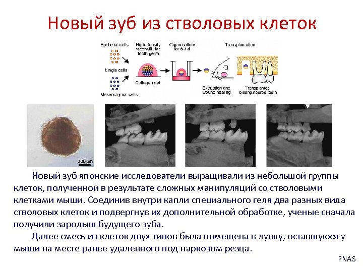 Новый зуб из стволовых клеток Новый зуб японские исследователи выращивали из небольшой группы клеток,
