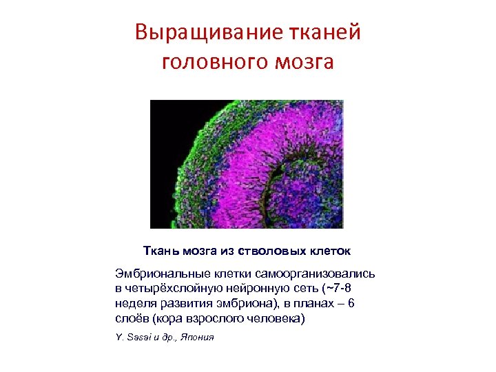 Растущие ткани. Ткань мозга человека. Стволовые клетки и выращивание органов и тканей.