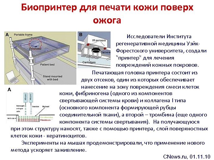 Биопринтер для печати кожи поверх ожога Исследователи Института регенеративной медицины Уэйк. Форестского университета, создали