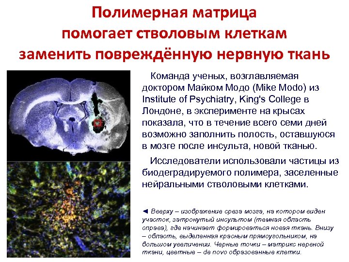 Полимерная матрица помогает стволовым клеткам заменить повреждённую нервную ткань Команда ученых, возглавляемая доктором Майком