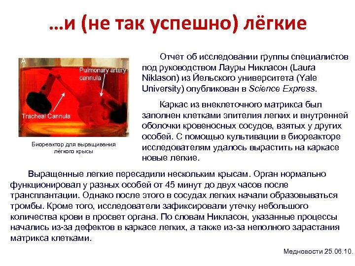 …и (не так успешно) лёгкие Отчет об исследовании группы специалистов под руководством Лауры Никласон