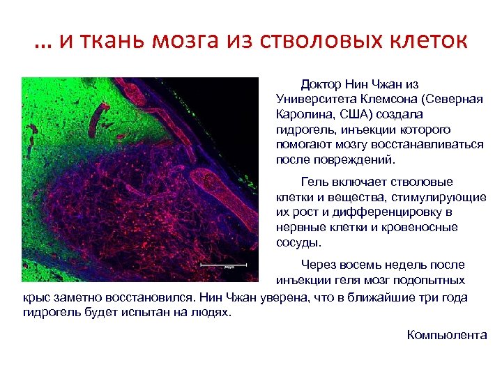 Состояние тканей. Ткань мозга. Ткань мозга человека. Ткань из стволовых клеток.