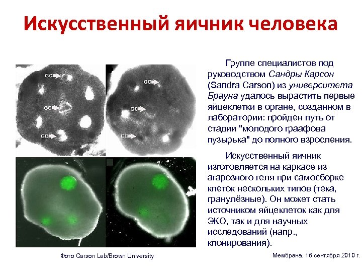 Искусственный яичник человека Группе специалистов под руководством Сандры Карсон (Sandra Carson) из университета Брауна