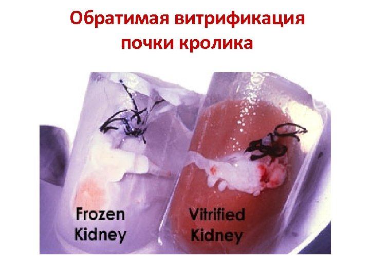 Обратимая витрификация почки кролика 