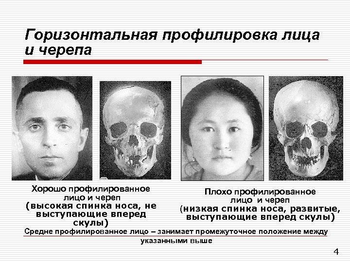 Горизонтальная профилировка лица и черепа Хорошо профилированное лицо и череп (высокая спинка носа, не