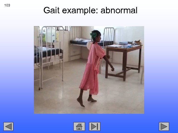103 Gait example: abnormal 