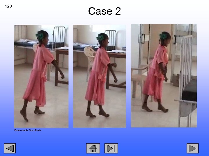 123 Case 2 Photo credit: Tom Shulz 