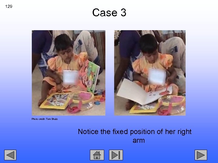 129 Case 3 Photo credit: Tom Shulz Notice the fixed position of her right