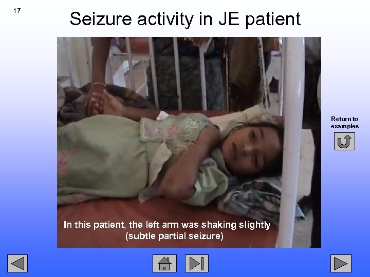 17 Seizure activity in JE patient Return to examples In this patient, the left