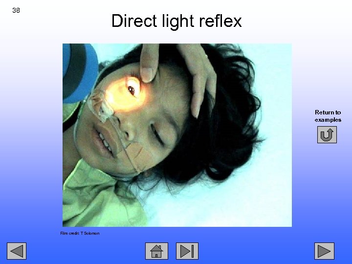 38 Direct light reflex Return to examples Film credit: T Solomon 