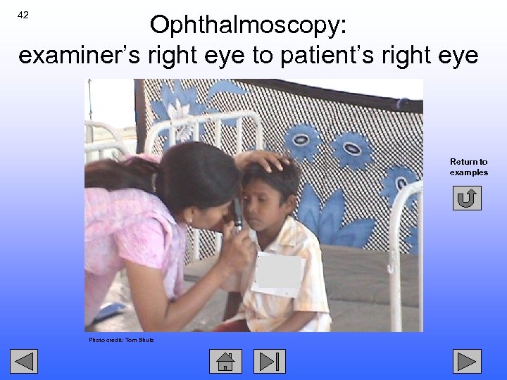 42 Ophthalmoscopy: examiner’s right eye to patient’s right eye Return to examples Photo credit: