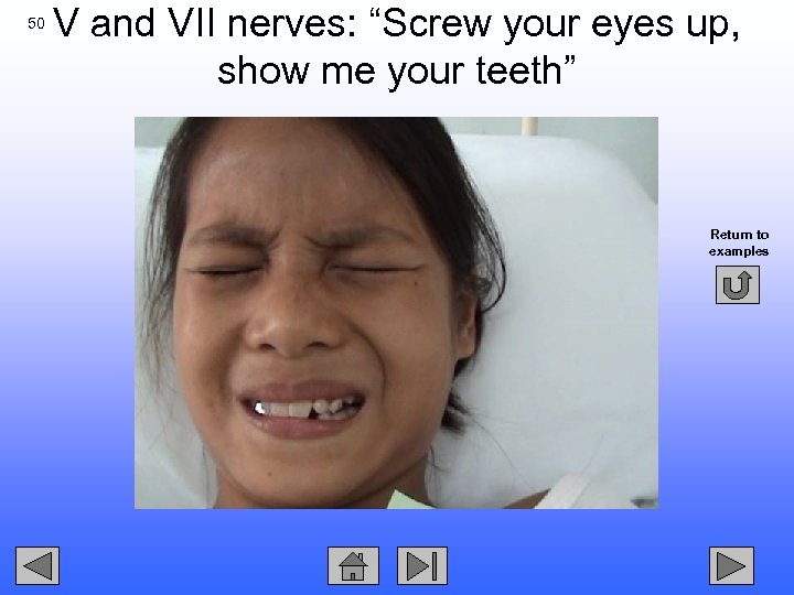 50 V and VII nerves: “Screw your eyes up, show me your teeth” Return