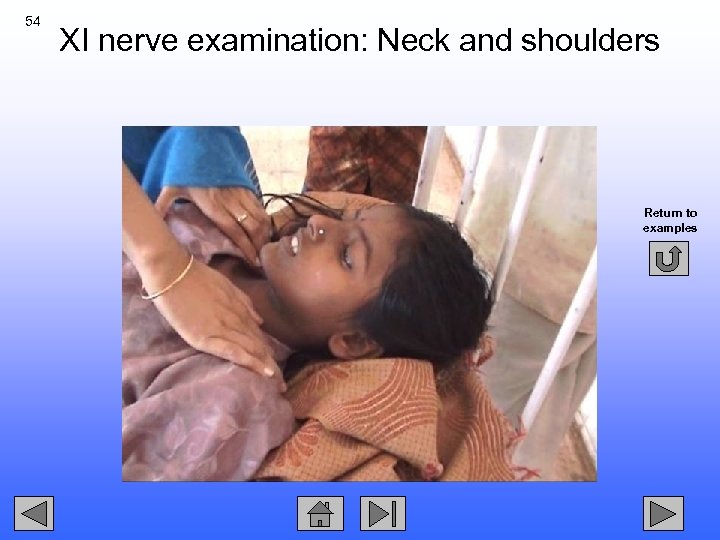 54 XI nerve examination: Neck and shoulders Return to examples 