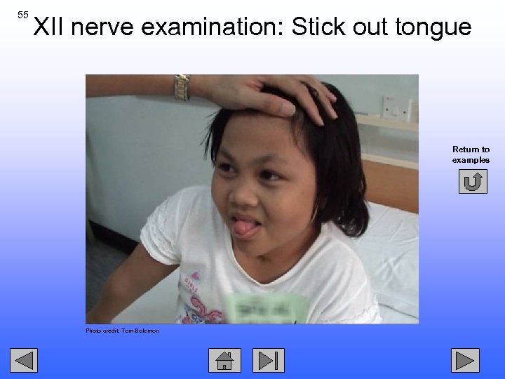 55 XII nerve examination: Stick out tongue Return to examples Photo credit: Tom Solomon