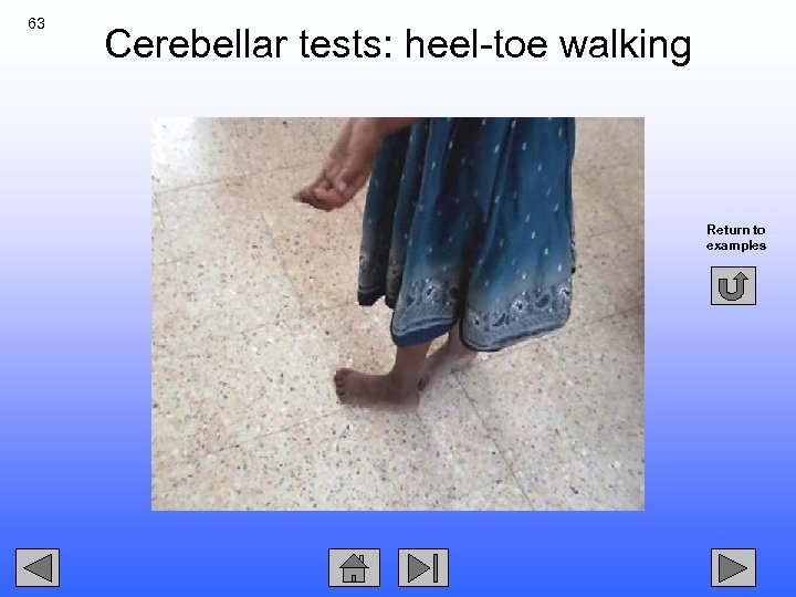63 Cerebellar tests: heel-toe walking Return to examples 