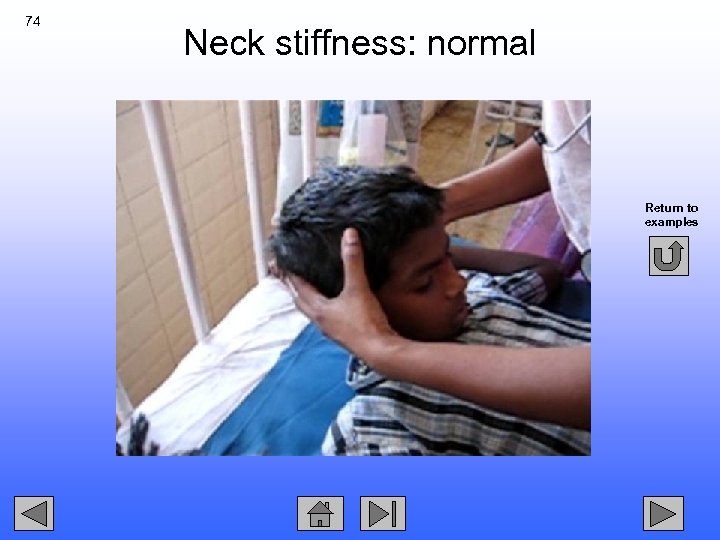 74 Neck stiffness: normal Return to examples 