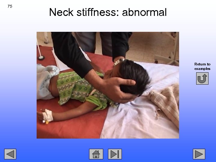 75 Neck stiffness: abnormal Return to examples 