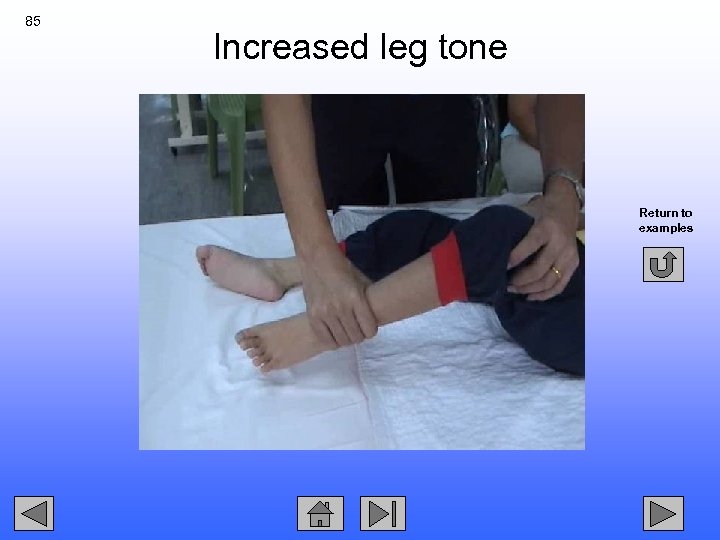 85 Increased leg tone Return to examples 