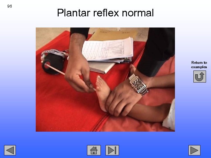 96 Plantar reflex normal Return to examples 