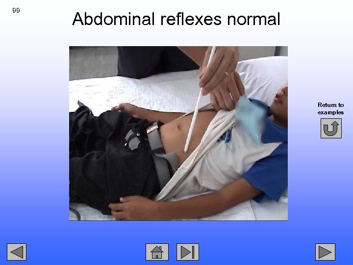 99 Abdominal reflexes normal Return to examples 