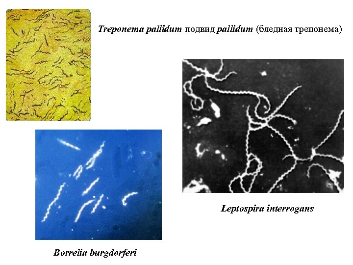 Бледная трепонема treponema pallidum. Treponema pallidum микробиология. Трепонема сифилиса микробиология. Спирохета бледная трепонема.