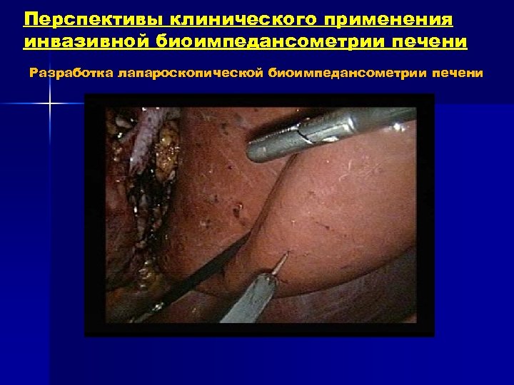Перспективы клинического применения инвазивной биоимпедансометрии печени Разработка лапароскопической биоимпедансометрии печени 