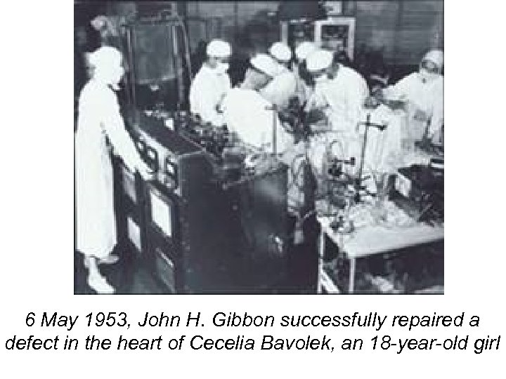 6 May 1953, John H. Gibbon successfully repaired a defect in the heart of