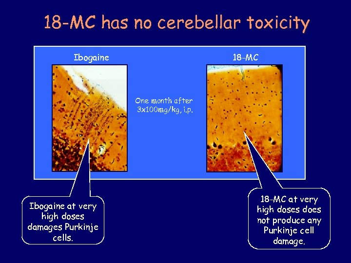 18 -MC has no cerebellar toxicity Ibogaine 18 -MC One month after 3 x