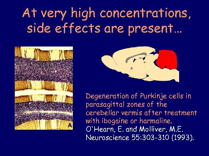 At very high concentrations, side effects are present… Degeneration of Purkinje cells in parasagittal