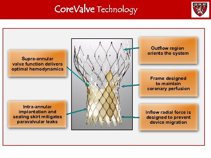Core. Valve Technology Outflow region orients the system Supra-annular valve function delivers optimal hemodynamics