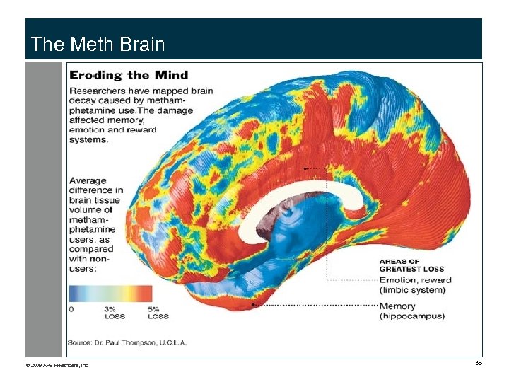 The Meth Brain © 2009 APS Healthcare, Inc. 33 