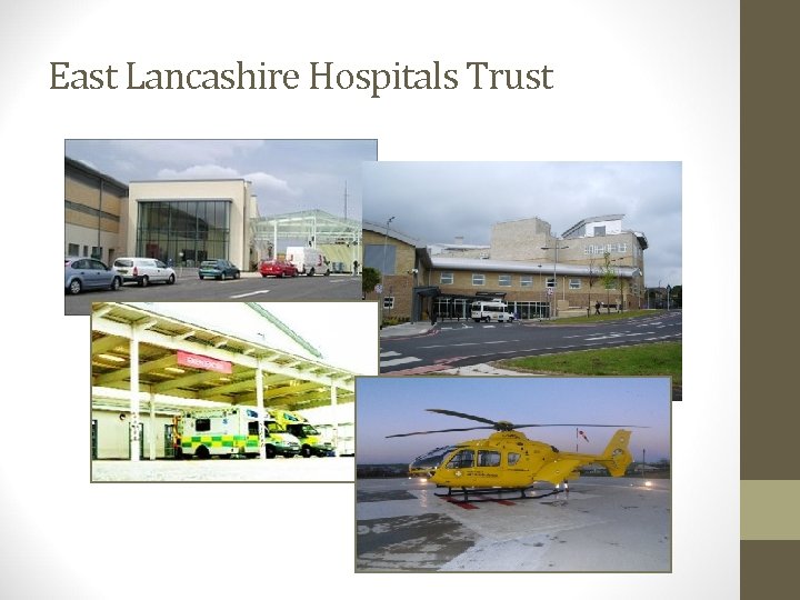 East Lancashire Hospitals Trust 