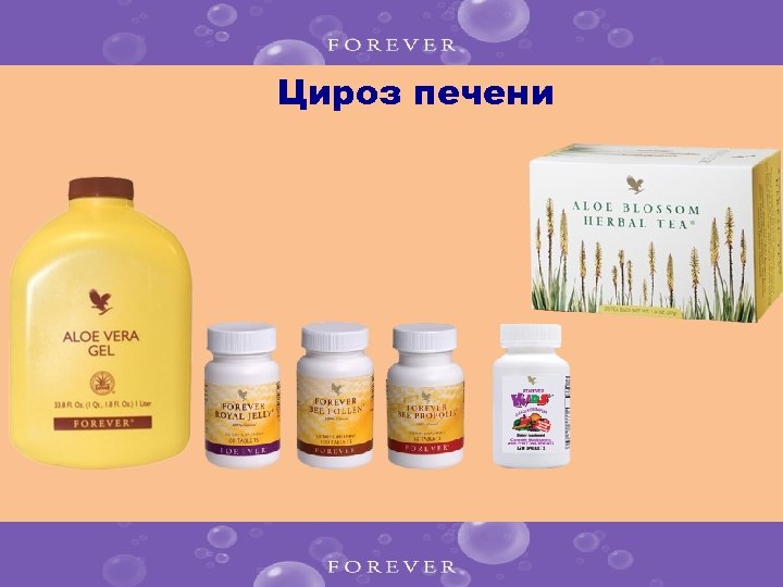 Цироз печени 