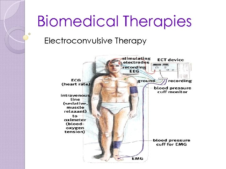 Biomedical Therapies Electroconvulsive Therapy 