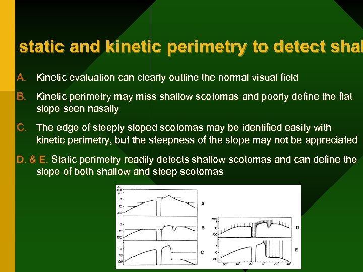of static and kinetic perimetry to detect shal A. Kinetic evaluation can clearly outline