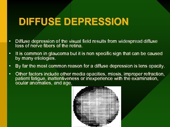 DIFFUSE DEPRESSION • Diffuse depression of the visual field results from widespread diffuse loss