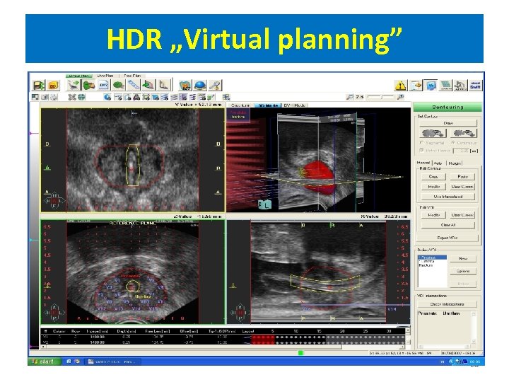 HDR „Virtual planning” 20 