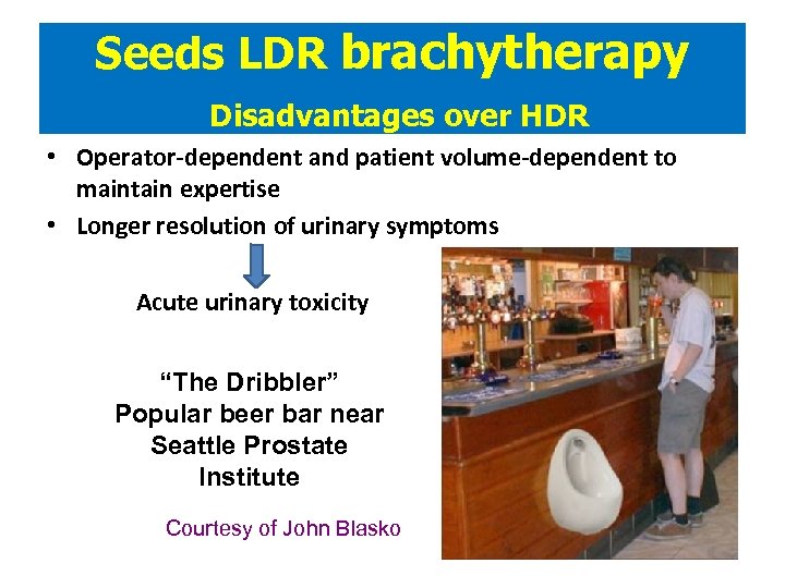 Seeds LDR brachytherapy Disadvantages over HDR • Operator-dependent and patient volume-dependent to maintain expertise