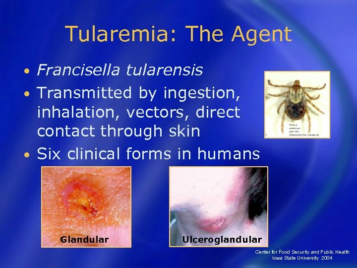 Tularemia: The Agent Francisella tularensis • Transmitted by ingestion, inhalation, vectors, direct contact through