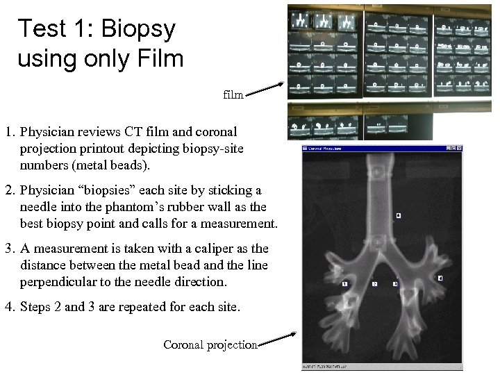 Test 1: Biopsy using only Film film 1. Physician reviews CT film and coronal