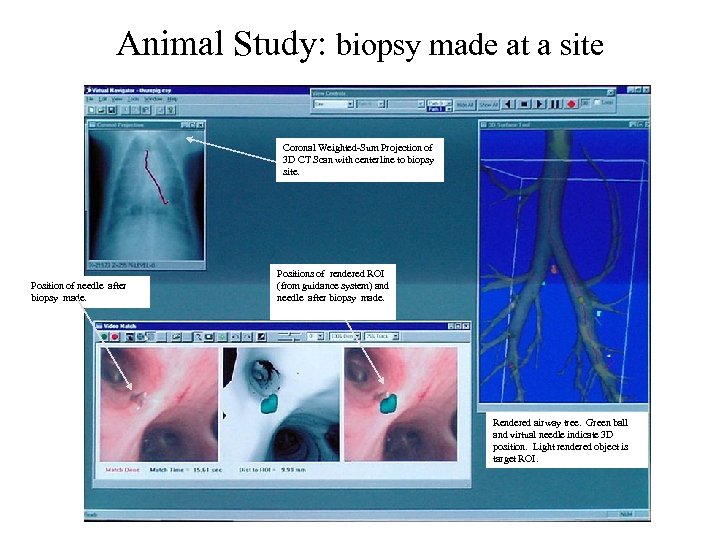 Animal Study: biopsy made at a site Coronal Weighted-Sum Projection of 3 D CT