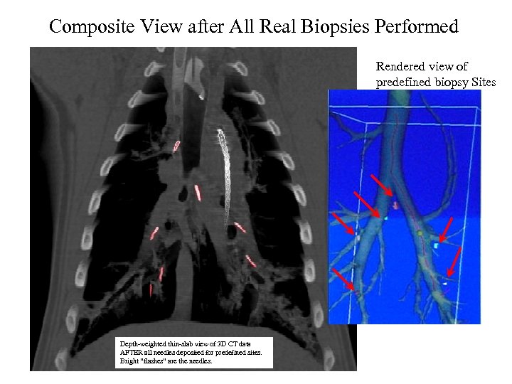 Composite View after All Real Biopsies Performed Rendered view of predefined biopsy Sites Depth-weighted